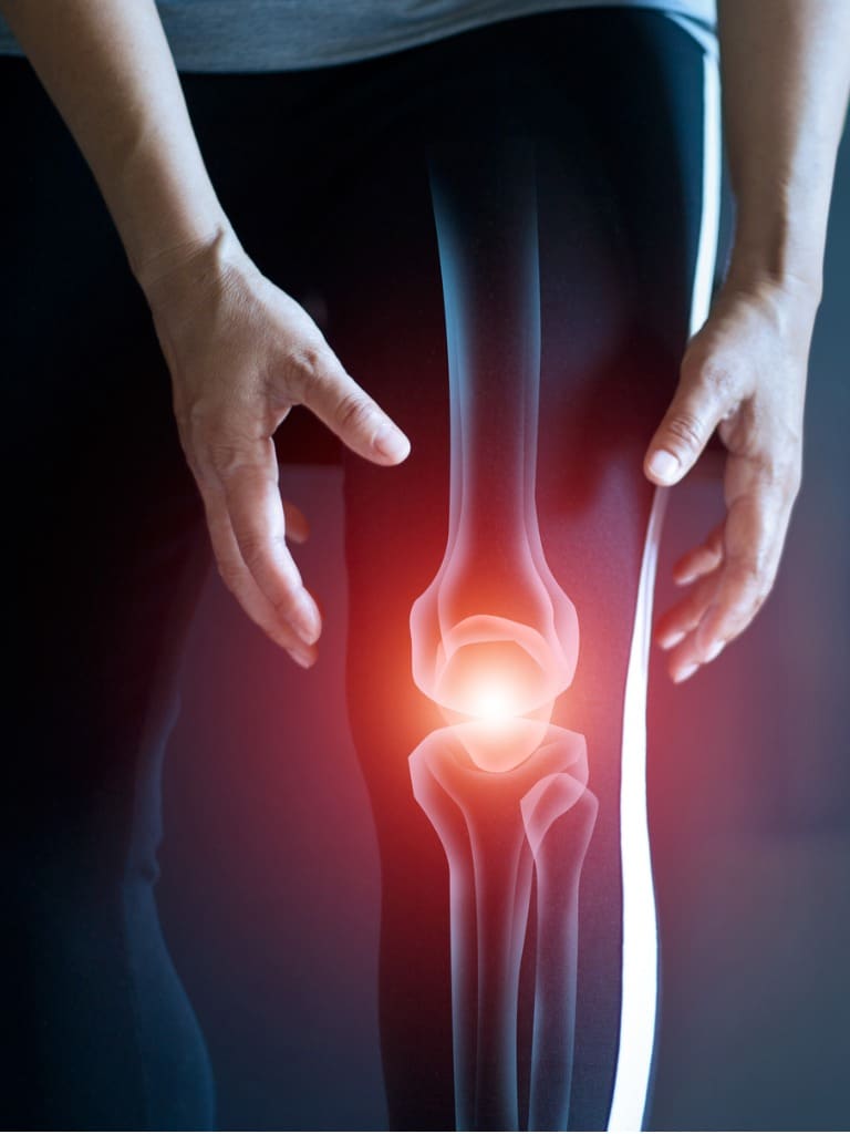 woman suffering from pain in knee injury from workout and tendon picture id1206802082